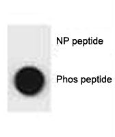 Phospho-p62 Antibody (pS207)