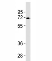 SPHK2 Antibody