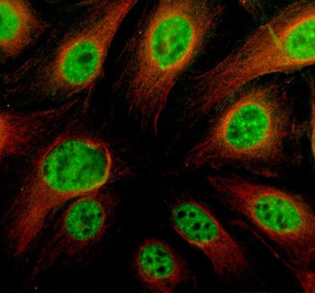 Immunofluorescent staining of TRIM11 using anti-TRIM11 antibody (green) and anti-Alpha Tubulin antib