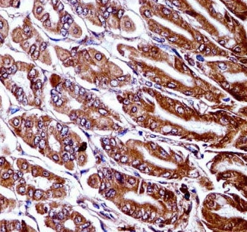 Tak1 Antibody / Map3k7