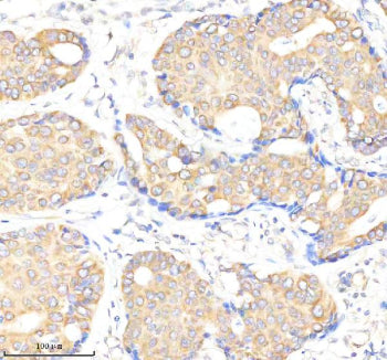 Immunohistochemical staining of BMPR1A using anti-BMPR1A antibody. BMPR1A was detected in a paraffin