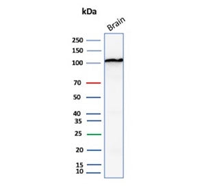 Western blot testing of human brain tissue lysate with Hexokinase 1 antibody (clone HK1/9515). Predi