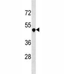DR3 Antibody (Death Receptor 3)