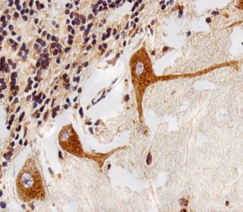 IHC testing of FFPE human cerebellum tissue with PPT1 antibody. HIER: steam section in pH6 citrate b