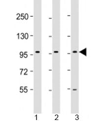 Western blot testing of human 1) HepG2, 2) PC-3 and 3) U-87 MG cell lysate with PCDH10 antibody at 1