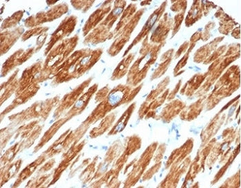 Desmin Antibody