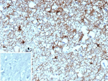 IHC staining of FFPE human brain tissue with GFAP antibody (clone GFAP/9420). Inset: PBS used in pla