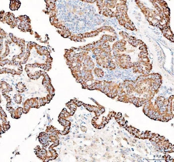 PPA2 Antibody / Inorganic pyrophosphatase 2
