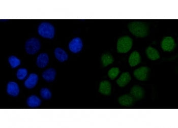 Anillin Antibody / Scraps