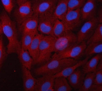 Alpha Taxilin Antibody / TXLNA