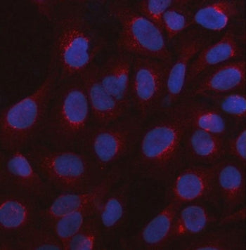 Immunofluorescent staining of FFPE human U-2 OS cells with 5-HT3C antibody (red) and DAPI nuclear st