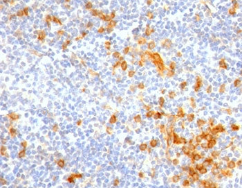 IHC staining of FFPE human tonsil with IL3RA antibody (clone CDLA123-1R). HIER: boil tissue sections
