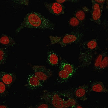 Immunofluorescent staining of fixed human SK-BR-3 cells with B7-H4 antibody (clone B7H4/1788, green)