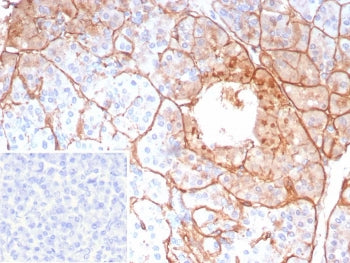 Collagen IV Antibody / COL4A5