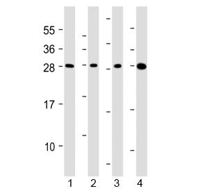 Western blot testing of human 1) HepG2, 2) U266B1, 3) HEK293 and 4) testis lysate with CLEC1B antibo