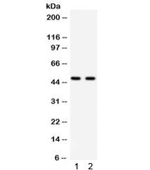 Western blot testing of 1) rat brain and 2) rat kidney lysate with PTOV1 antibody. Predicted/expecte