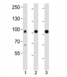 Western blot analysis of lysate from mouse 1) kidney, 2) lung and 3) skin tissue using Epha1 antibod