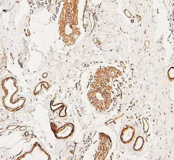 LPP Antibody / Lipoma preferred partner