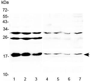 TSLP Antibody