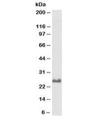 Western blot testing of rat brain lysate with biotinylated SNAP25 antibody at 0.1ug/ml. Expected mol