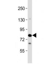 Western blot testing of human Jurkat cell lysate with SLP76 antibody at 1:2000. Predicted molecular
