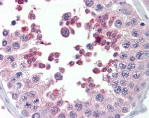 IHC testing of FFPE human testis with MLL4 antibody at 5ug/ml. HIER: steamed with pH6 citrate buffer