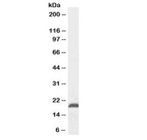 Nsg2 Antibody / Neuron Specific Gene 2