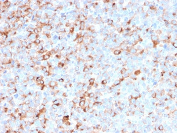 Tyrosinase Antibody Cocktail