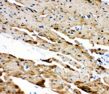 Phospholamban Antibody / PLN