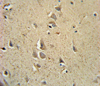 IHC staining of FFPE human brain tissue with SCN1B antibody. HIER: steam section in pH6 citrate buff