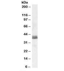 NDEL1 Antibody