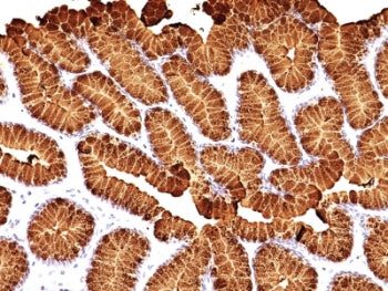 IHC: Formalin-fixed, paraffin-embedded human stomach stained with MUC5AC antibody (MUC5AC/917 + 45M1