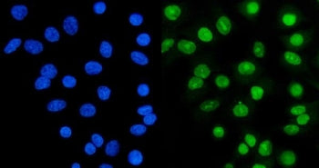 Ku70 Antibody