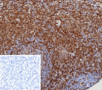 IHC staining of FFPE human tonsil tissue with MITA antibody (clone STING1/8129R). Inset: PBS used in