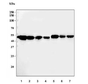ADK Antibody / Adenosine kinase
