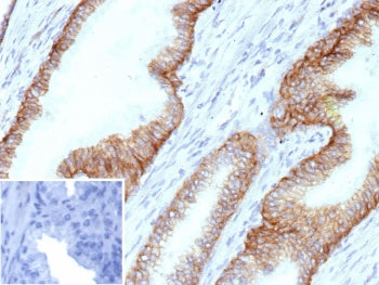 IHC staining of FFPE human prostate tissue with MOAT-B antibody (clone ABCC4/9178). Inset: PBS used