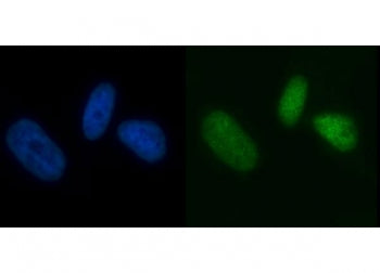 Immunofluorescent staining of FFPE human PC-3 cells with MCM7 antibody (green) and DAPI nuclear stai