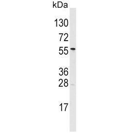 Western blot testing of human T-47D cell lysate with ALDH6A1 antibody. Predicted molecular weight: ~