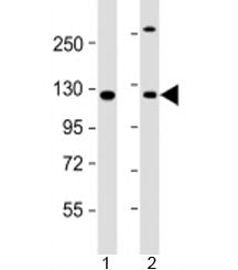 INTS6 Antibody / DICE1