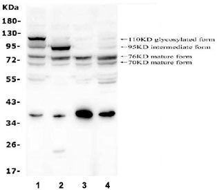 Western blot testing of human 1) A549, 2) HepG2, 3) HEK293 and 4) PC-3 cell lysate with GAA antibody