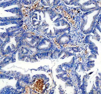 Immunohistochemical staining of TRIOBP using anti-TRIOBP antibody. TRIOBP was detected in a paraffin