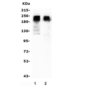 Western blot testing of 1) rat brain and 2) mouse brain lysate with GRM2 antibody. Predicted molecul