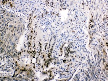FABP2 Antibody (intestinal)