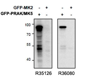 Western blot of HEK293 lysate overexpressing mouse MK5/PRAK (first lane) or mouse MK2 (second lane)