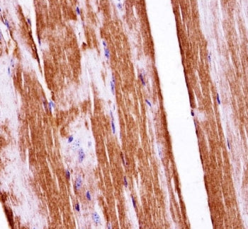 Raf1 Antibody / c-Raf