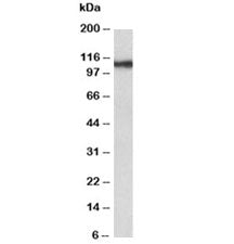 Western blot testing of human thyroid gland lysate with Thyroid Peroxidase antibody at 0.3ug/ml. Pre