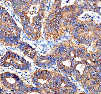 Immunohistochemical staining of Cathepsin F/CTSF using anti-CTSF antibody. Cathepsin F/CTSF was dete