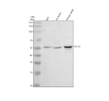 Western blot analysis of TTLL9 using anti-TTLL9 antibody. Electrophoresis was performed on a 10% SDS