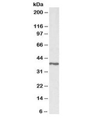 Western blot testing of pig testis lysate with PTGR2 antibody at 1ug/ml. Predicted molecular weight: