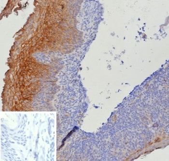 IHC staining of FFPE human tonsil tissue with Tissue Factor antibody (clone CD142/9195). Inset: PBS